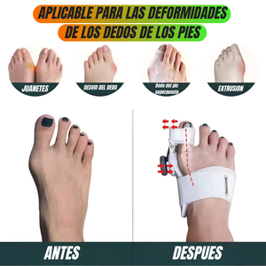 ✨ ¡Corrector Ortopédico para Juanetes! ✨